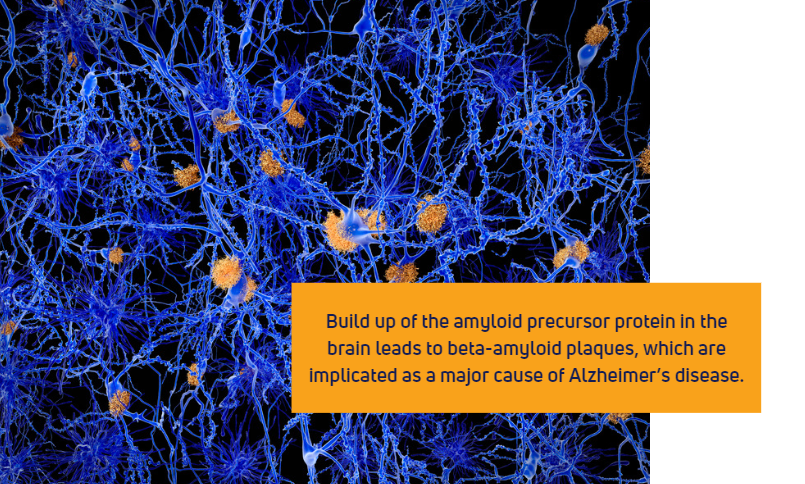 Beta-amyloid plaques