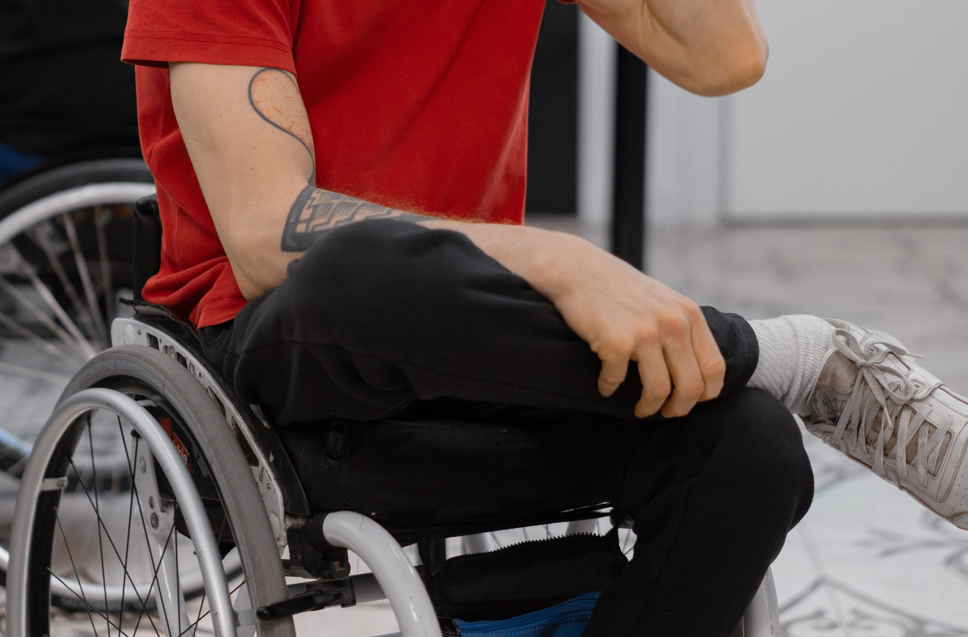 Tardive Dyskinesia